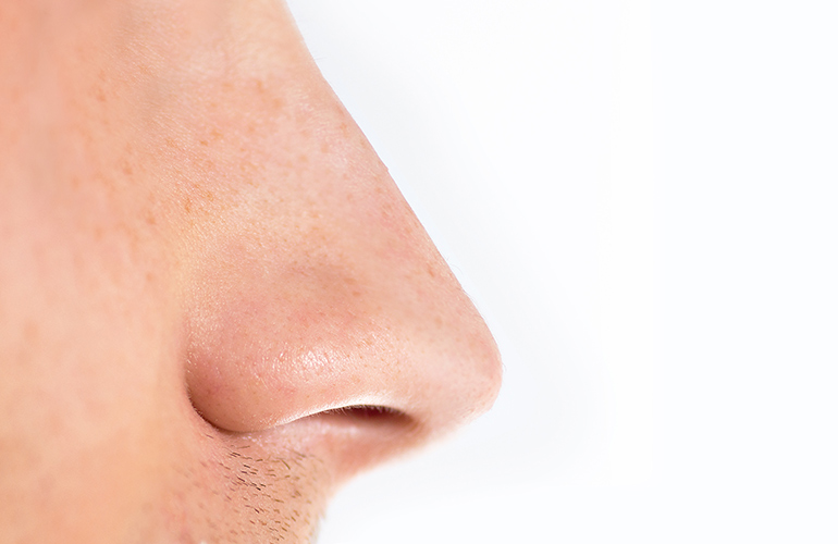Does disease smell?