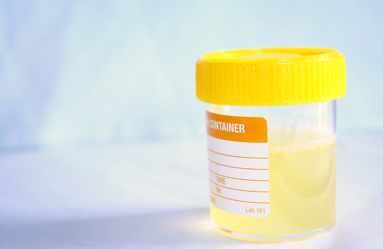 Your urine is cloudy