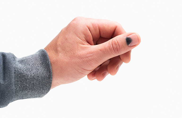 You notice a black streak on your nail