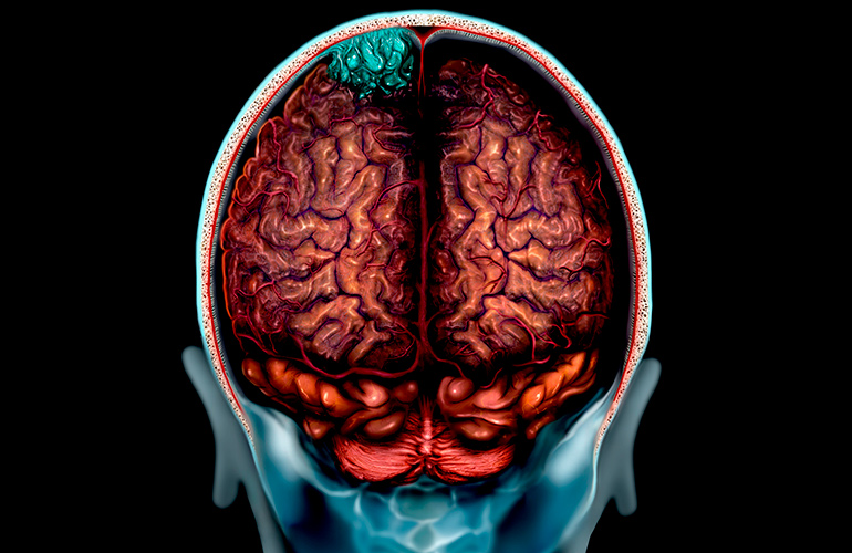 You only use 10 percent of your brain