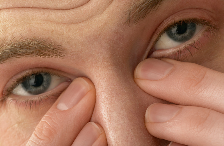 Watery eyes and runny nose