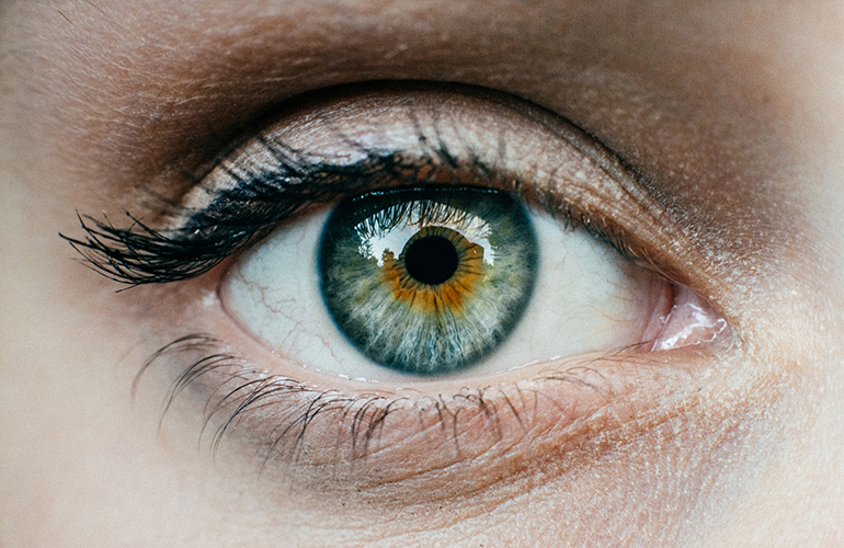 Soft, yellow spots on eyelids