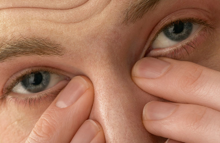 Ocular migraine