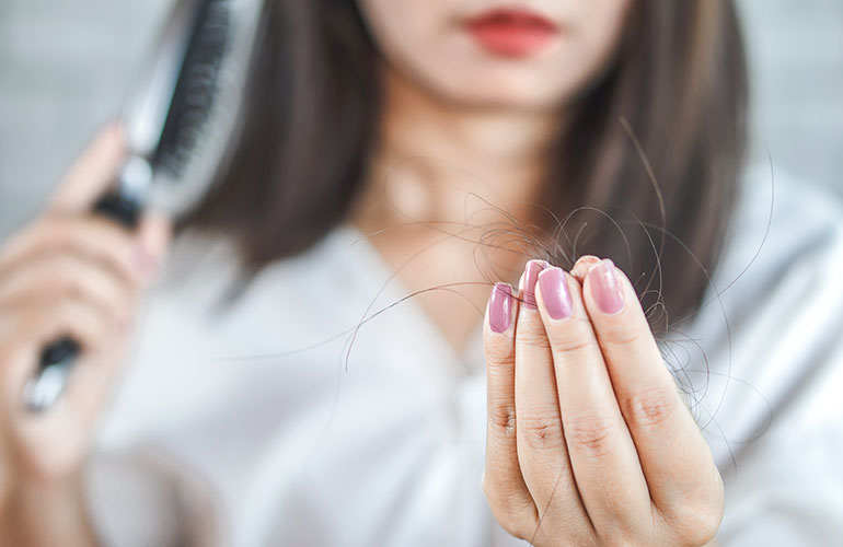 Hair loss