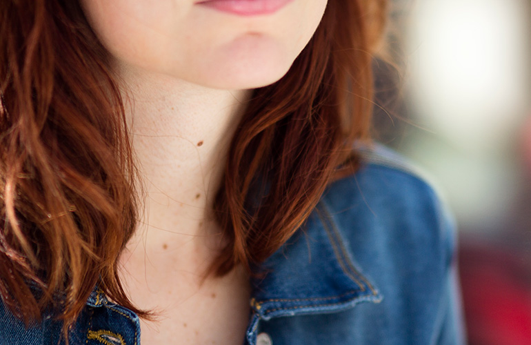 New moles