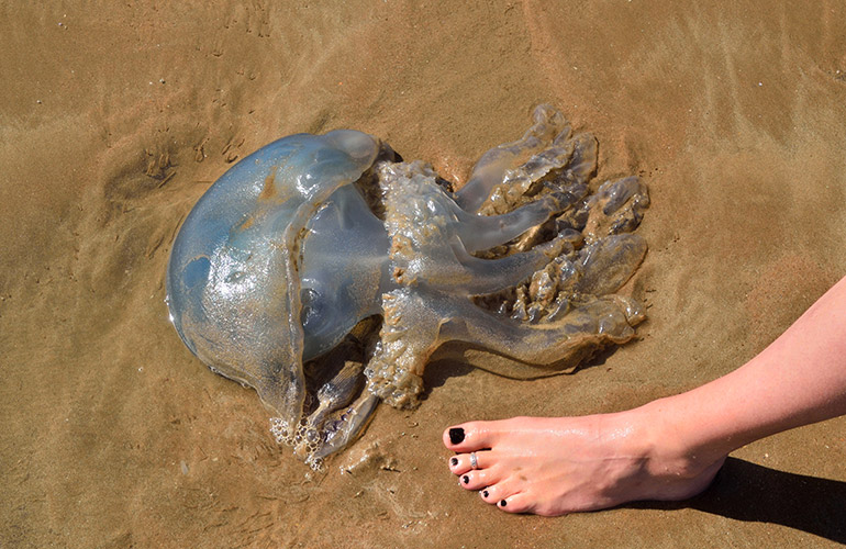 Soothe a jellyfish sting