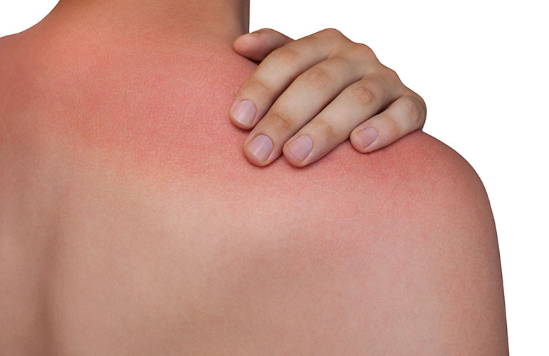 Apply for a deep tan