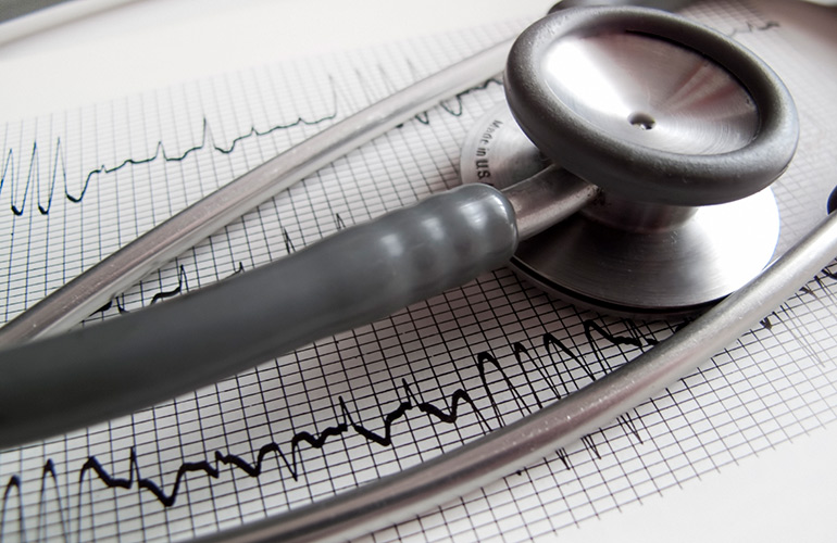 Intermittent fasting may lower your risk for cardiovascular disease