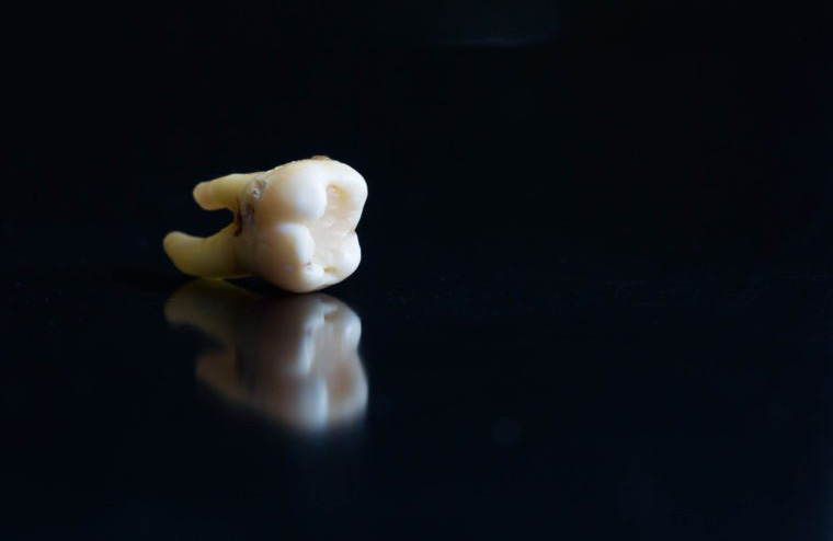 Your teeth feel loose or fall out