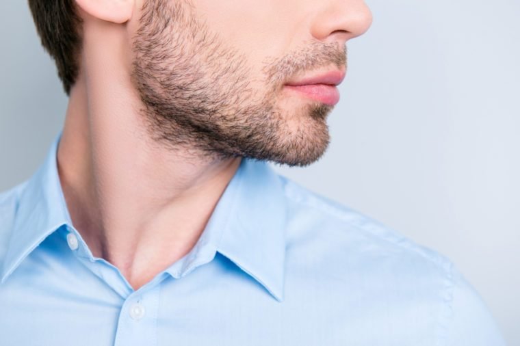 Ingrown hairs