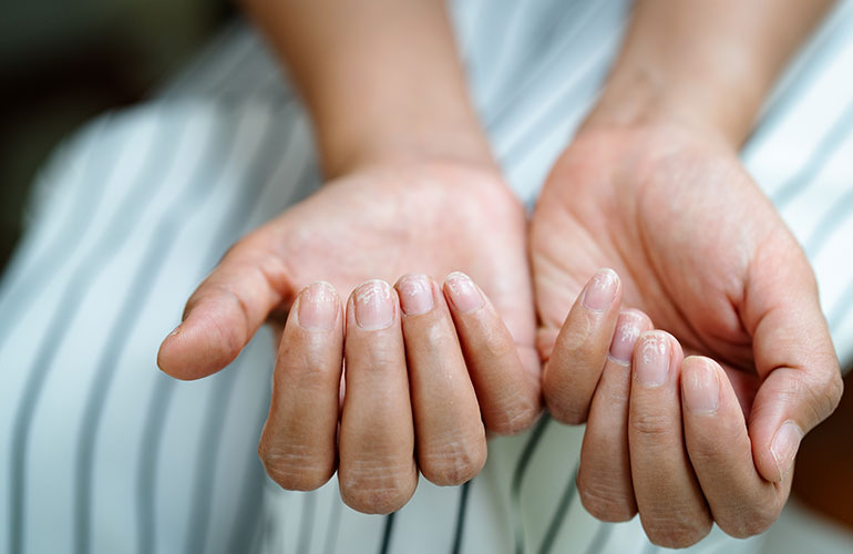 Gel manicures may weaken your nails