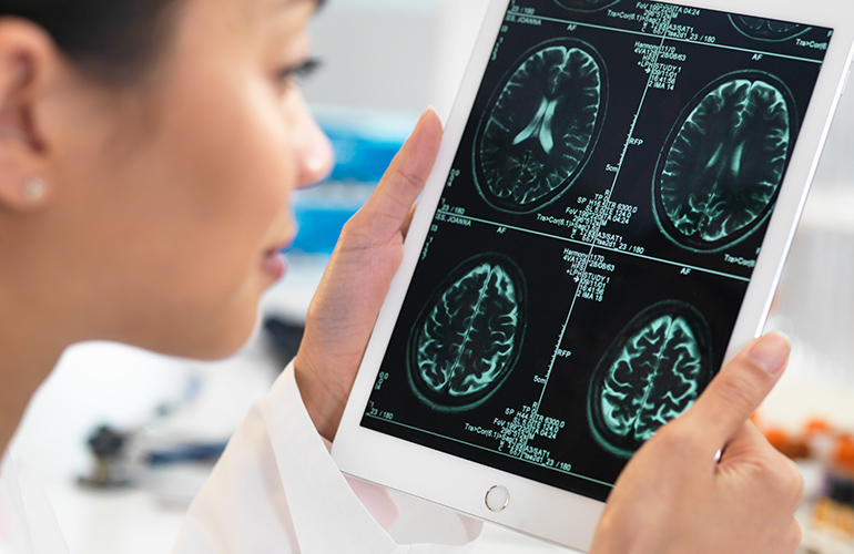 Turmeric may prevent Alzheimer’s