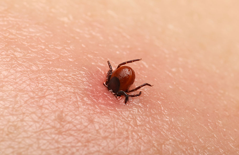 It may be Lyme disease