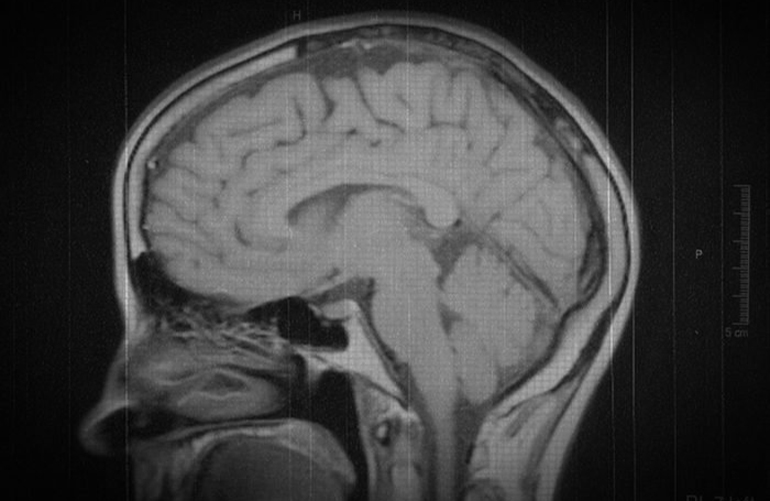 The darkness of the mind