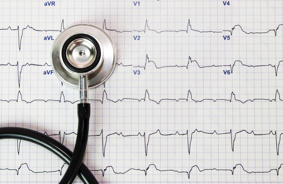 Arthritis boosts your odds for heart disease
