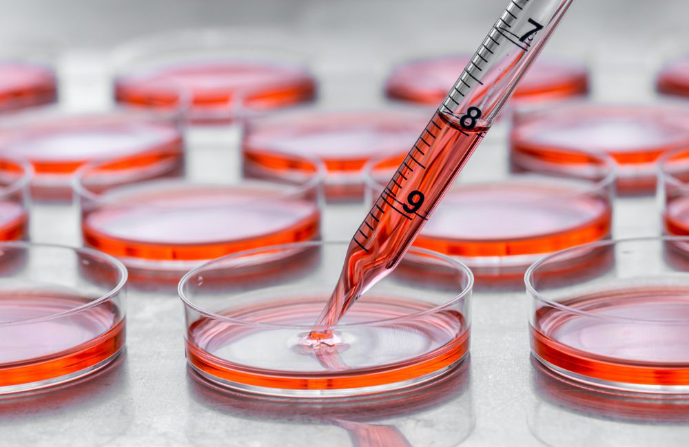 Stem cells could save joints – someday