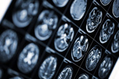 15 things to start doing at 50 that’ll save your brain at 80
