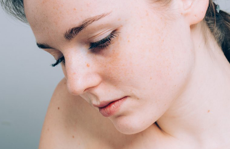 There’s a new freckle on your face