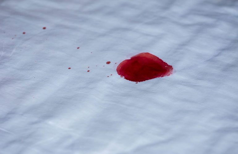 All stains are created equal