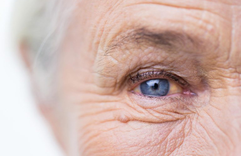 Dementia risk factors you could control