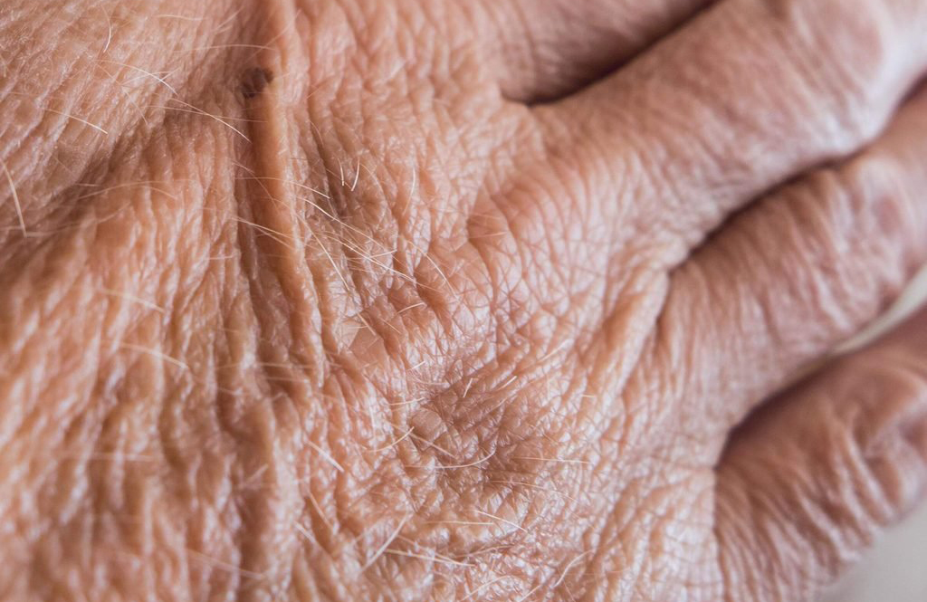 Your wrinkles will fade away