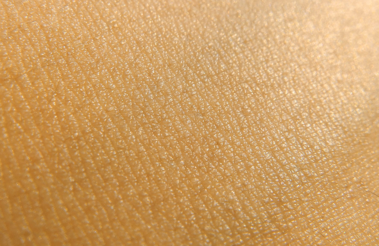 Your skin gets discoloured