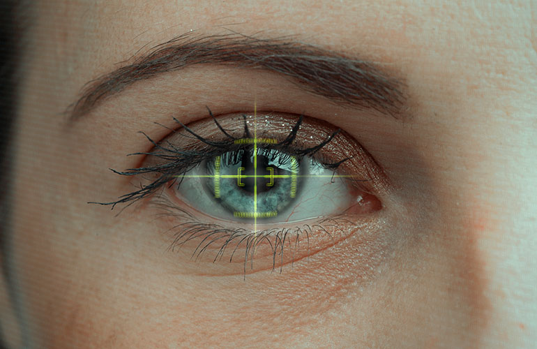 Glaucoma