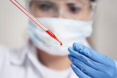 blood sample