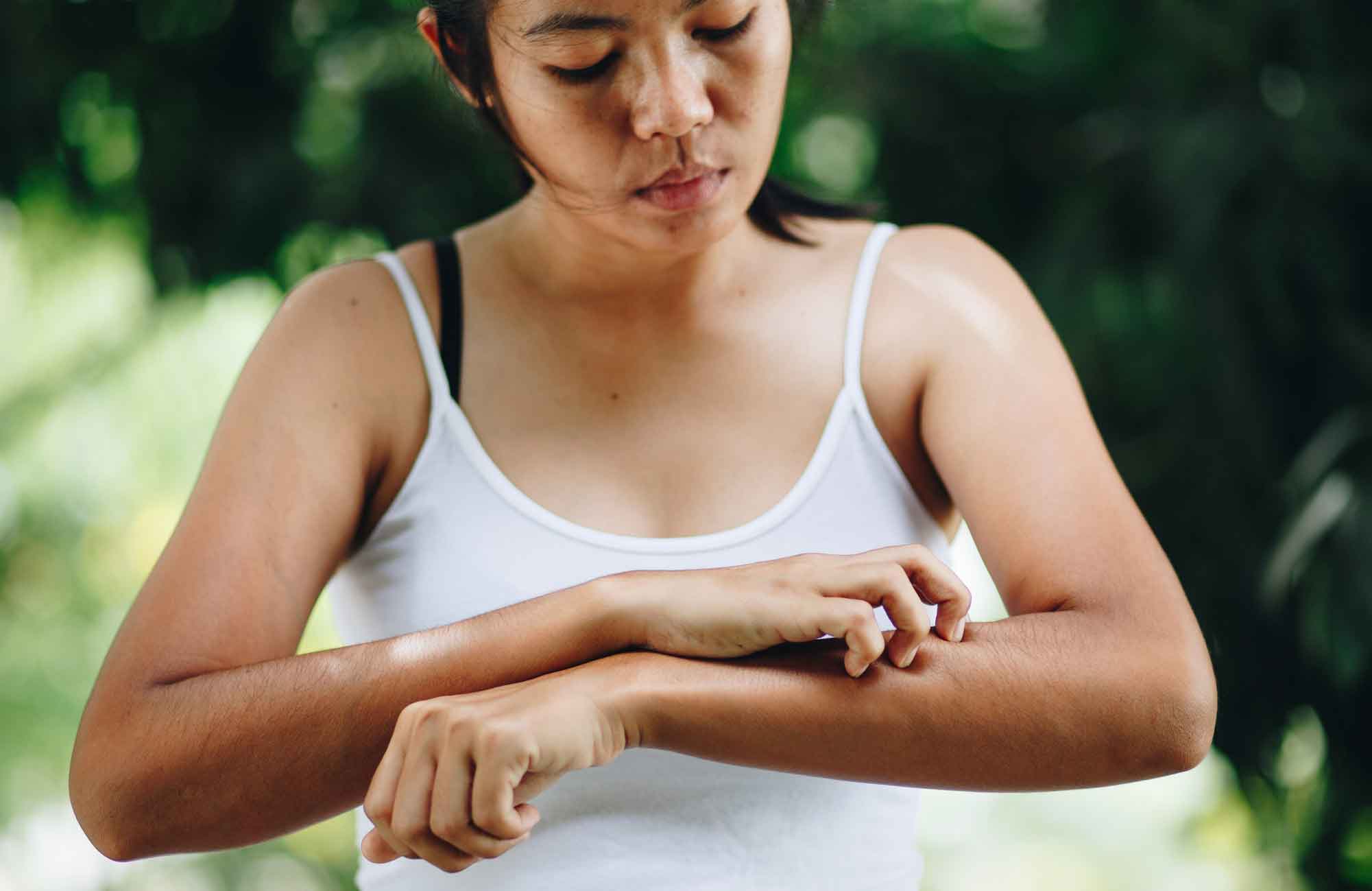 Soothe eczema (and other itchy rashes)