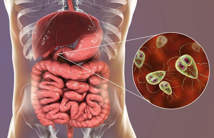 What is a parasite?