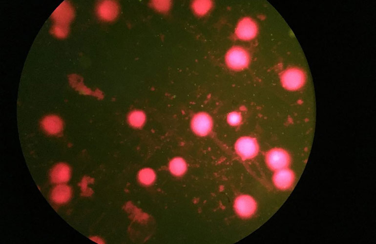 Chlamydia