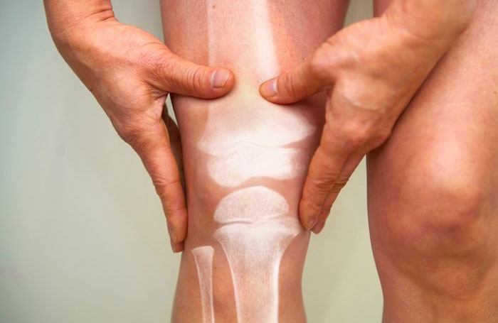 Should I be worried about hearing other bones crack?