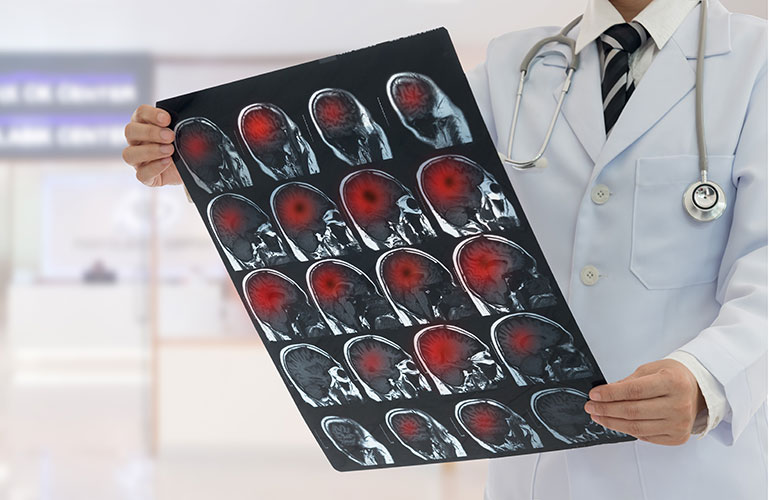 Sign: you have stroke symptoms