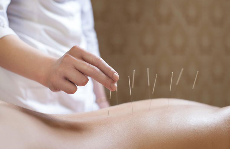 Make an appointment with an acupuncturist