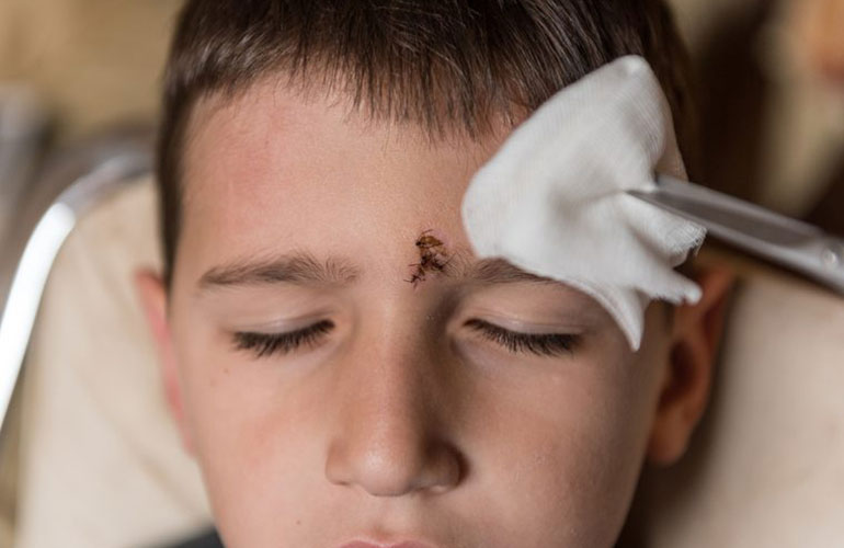 It drives me crazy when parents call from the emergency room because their kid got a scratch on his face
