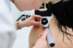 12 silent signs of skin cancer you’re probably ignoring