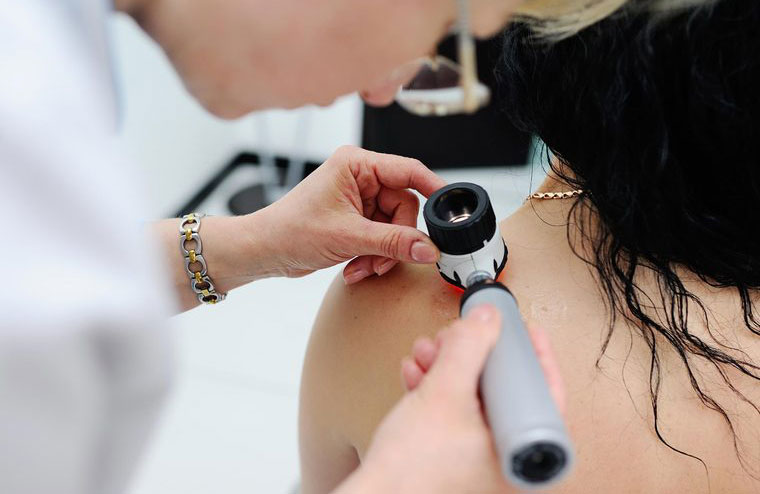Subtle signs of skin cancer you shouldn’t ignore