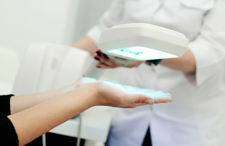 You’ve had PUVA treatments