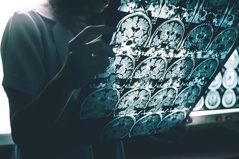 Causes of dementia are vastly different