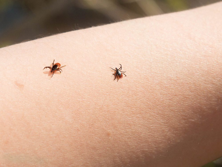 Lyme disease