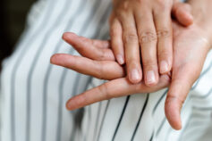 Name that rash: 6 common skin conditions (and how to treat them)